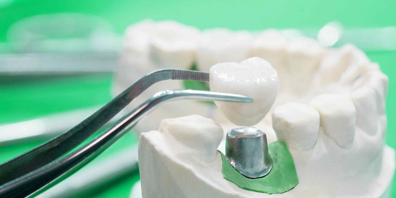 https://clinicasmileway.com/wp-content/uploads/2020/01/post-28-1280x640.jpg